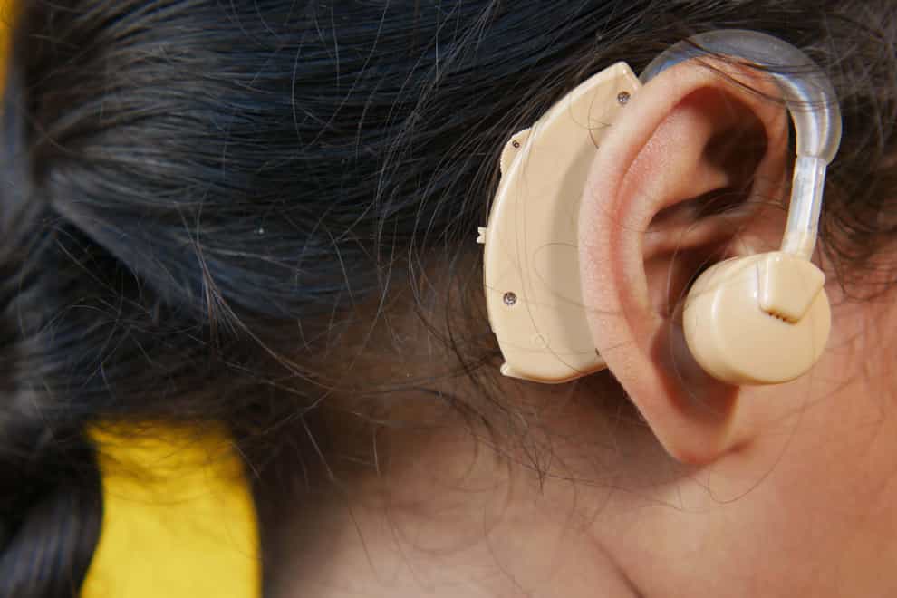 Gene therapy helps restores hearing in children with hereditary deafness (Alamy/PA)