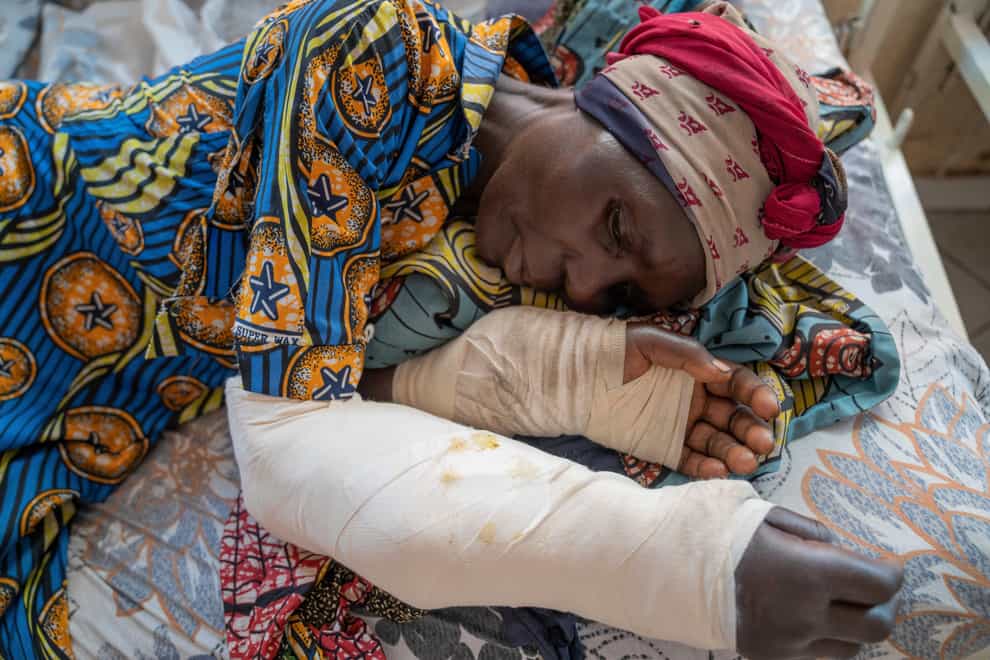 A woman who was wounded in ongoing fighting between M23 rebel forces and Congolese forces in the Sake region west of Goma lies on her hospital bed (Moses Sawasawa/AP)