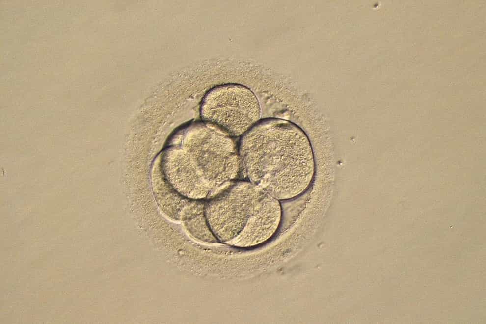 A photo of a three-day-old human embryo (PA)