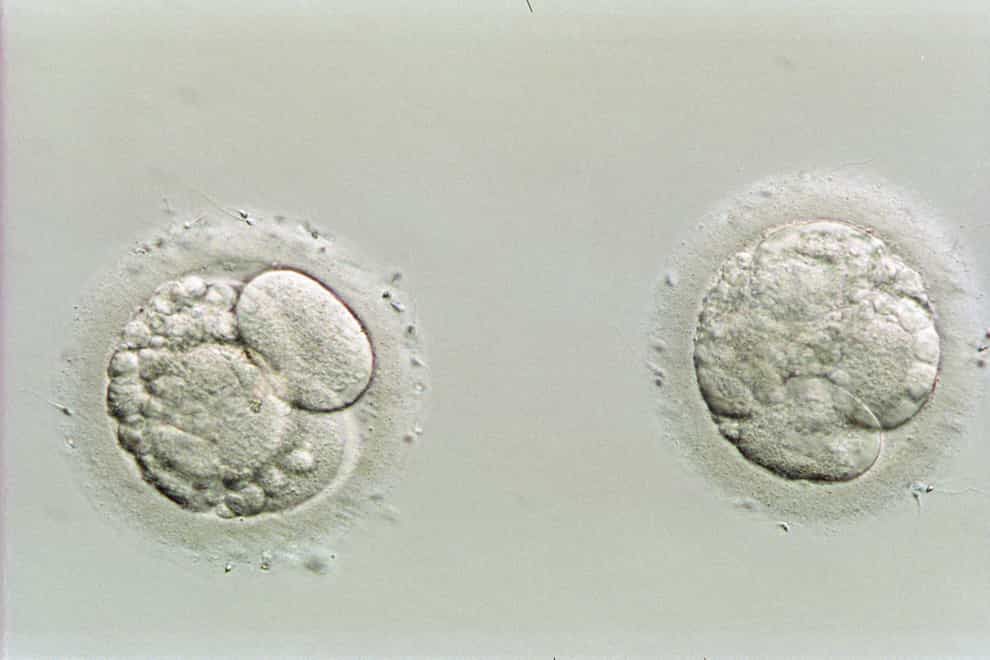 Four-day-old human embryos (Alamy/PA)