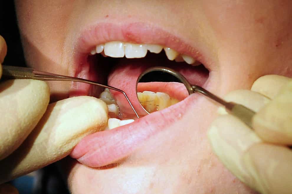 Ministers are proposing new powers for the General Dental Council to provisionally register dentists who qualified outside the UK (Rui Vieira/PA)