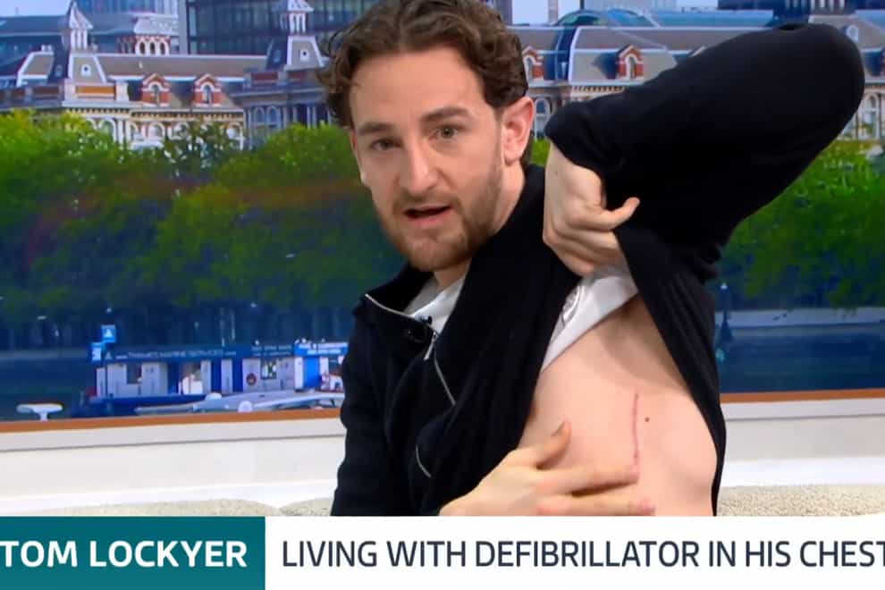 Tom Lockyer showed the scars of his new defibrilator (Good Morning Britin/ITV)