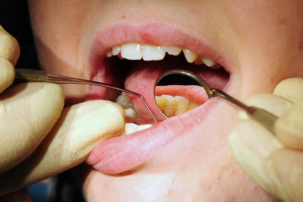 Concerns have been raised over the Government’s dental recovery plan (PA)